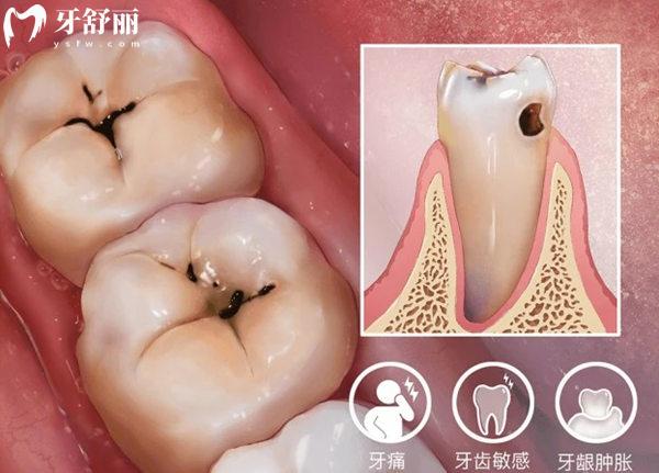 石家莊牙科醫(yī)院補牙多少錢？收費標準99-800元左右