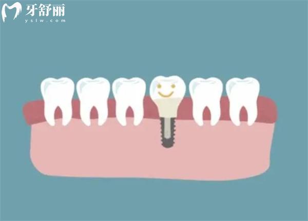 西寧牙科收費(fèi)價(jià)目表