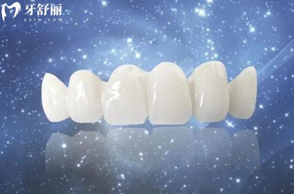 西寧鑲牙多少錢一顆