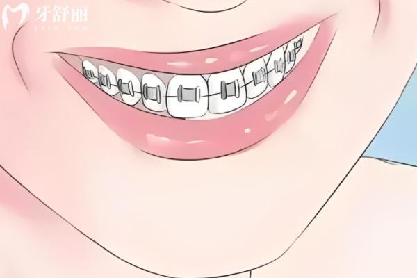鎮(zhèn)江牙科收費(fèi)標(biāo)準(zhǔn)表