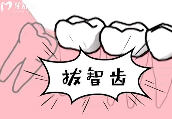 簡單智齒和復雜智齒的區(qū)別