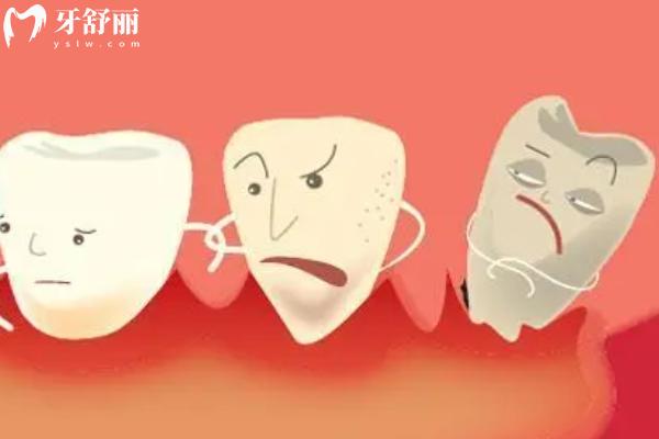 先洗牙還是先拔牙補(bǔ)牙？
