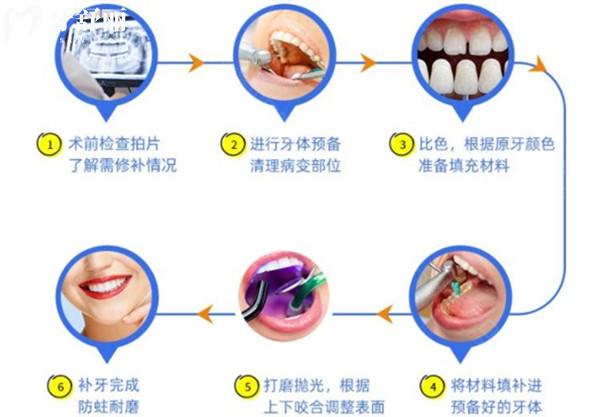 十歲孩子補(bǔ)牙，長大后還需要補(bǔ)嗎