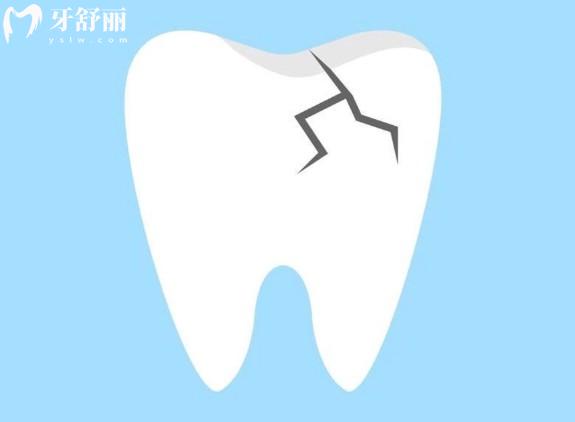 杭州牙科醫(yī)院其他相關(guān)費(fèi)用
