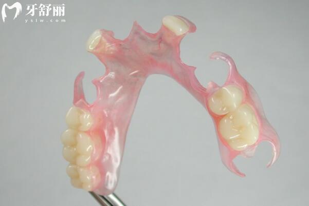 上海裝全口腔假牙的費(fèi)用大概是多少呢?2025年無掛鉤/吸附/種植牙價(jià)格清單