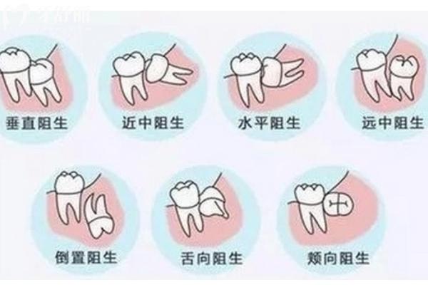 杭州富陽(yáng)口腔