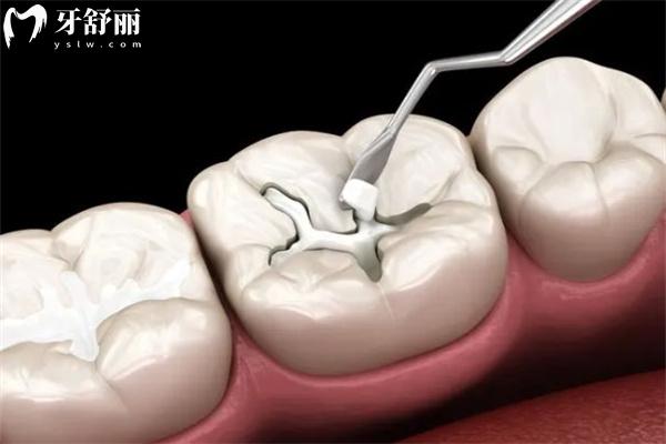 昌平正規(guī)牙科價(jià)格表