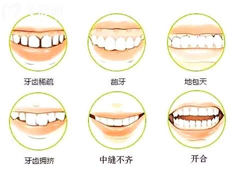 2025年樂(lè)山口腔醫(yī)院收費(fèi)標(biāo)準(zhǔn)持續(xù)上新:全瓷假牙1600+