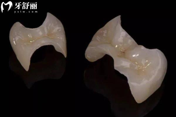 25年寧波補牙多少錢一顆牙價格表