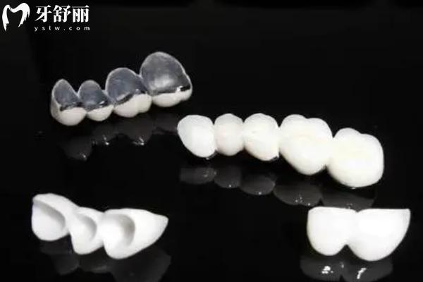 宿遷看牙貴不貴？宿遷口腔醫(yī)院價格表