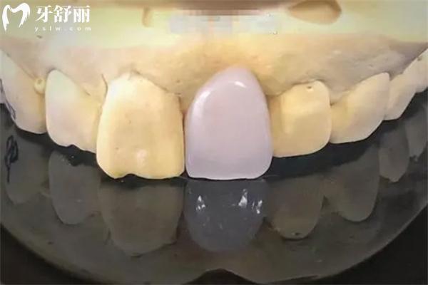 2025天門(mén)口腔醫(yī)院價(jià)目表別錯(cuò)過(guò)!種植牙2000+牙齒矯正4000+補(bǔ)牙68+