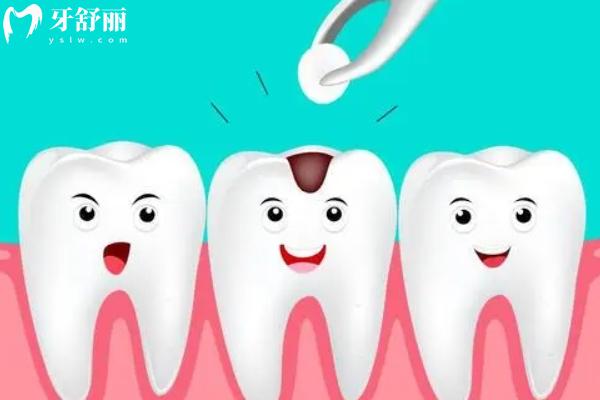 惠州補(bǔ)牙多少錢一顆？