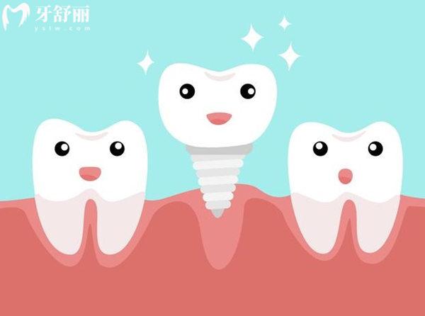 嘉興口腔醫(yī)院種植牙價(jià)格是多少