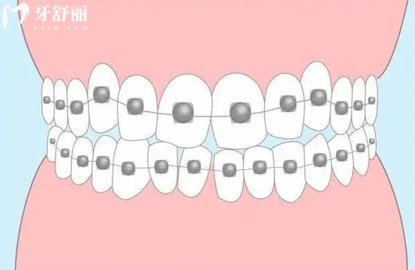 臨汾口腔醫(yī)院牙齒矯正價(jià)格