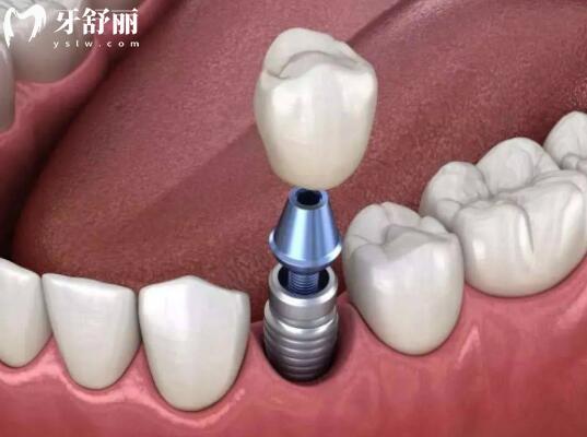 天津中幸口腔醫(yī)院2025收費標(biāo)準(zhǔn)來襲:洗牙90元起