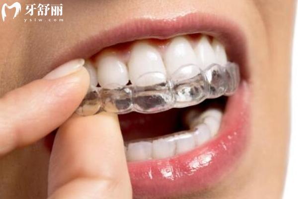 2025樂山英美口腔價(jià)目表分享，矯正5000+補(bǔ)牙150+根管600+潔牙30+
