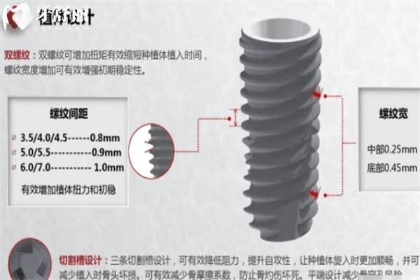 上海牙科醫(yī)院種植牙價(jià)格表一覽