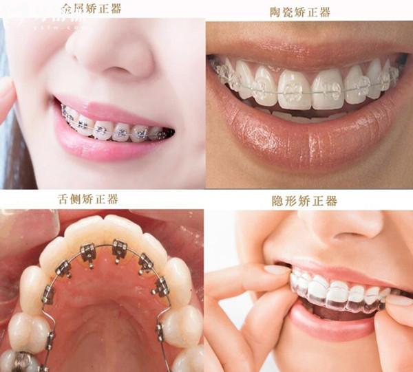 2025遂寧啟辰口腔收費(fèi)價(jià)目表明細(xì):種植牙價(jià)格1988元+/矯正4980元+可預(yù)約