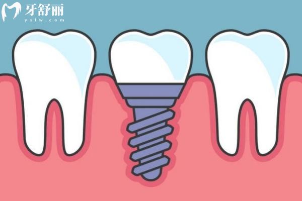 南寧三分白口腔怎么樣