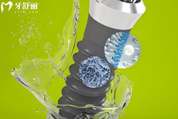 2025年重慶口腔醫(yī)院種植牙價(jià)格