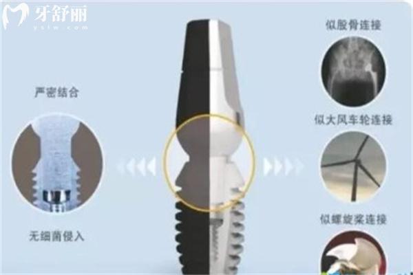 天津種植牙齒多少錢一顆?25年價格一覽表顯示1880元/顆起附正規(guī)口碑牙科醫(yī)院
