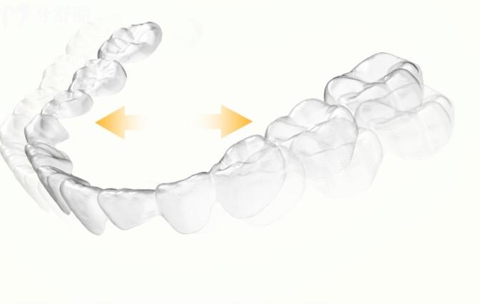 重慶兒童牙齒矯正價(jià)格表