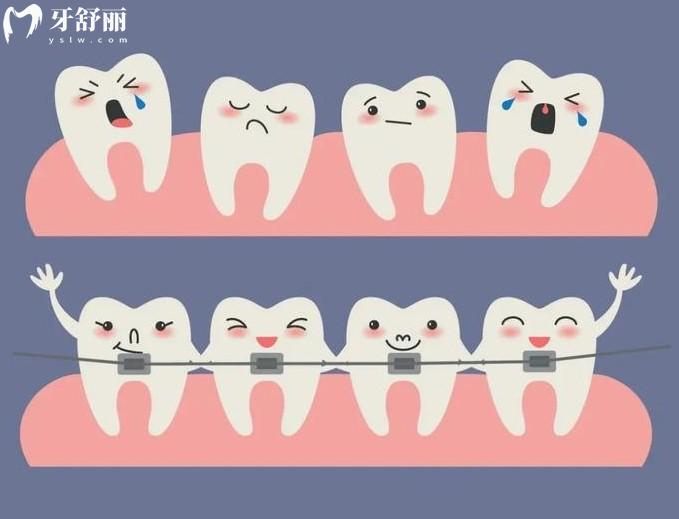 牙管家口腔收費(fèi)標(biāo)準(zhǔn)
