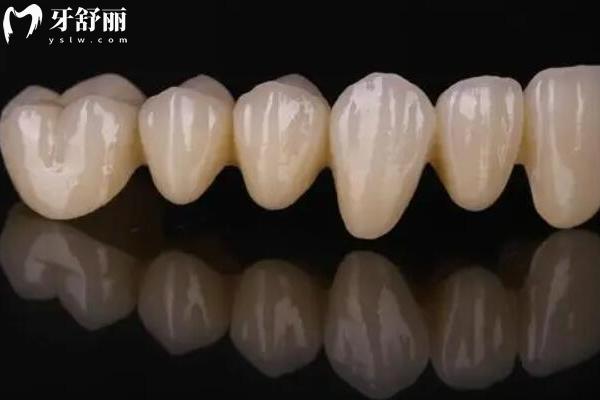 2025長春華益口腔價目表，修復(fù)兒牙種植矯正等口腔項(xiàng)目大全