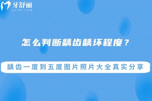怎么判斷齲齒齲壞程度?齲齒一度到五度圖片照片大全真實分享