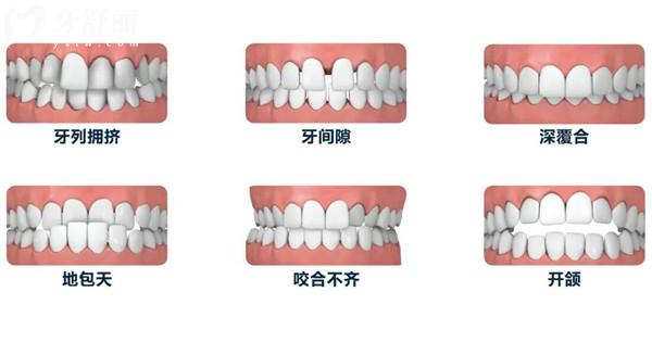 超全九江牙科收費(fèi)標(biāo)準(zhǔn)(2025價(jià)目表)拔牙50+