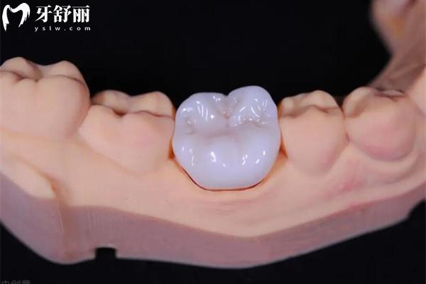 好大夫口腔收費(fèi)標(biāo)準(zhǔn)