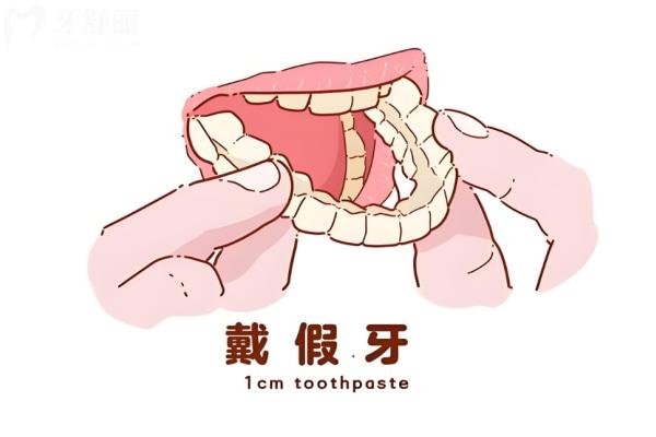 年輕人用什么假牙比較好?年輕人裝假牙能吃硬東西嗎?這份指南讓你吃得香笑得更自信