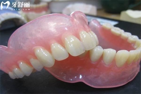 吸附式假牙費(fèi)用價(jià)格一覽表:全口假牙約1-3w元不等相關(guān)佩戴原理及適合人群了解下