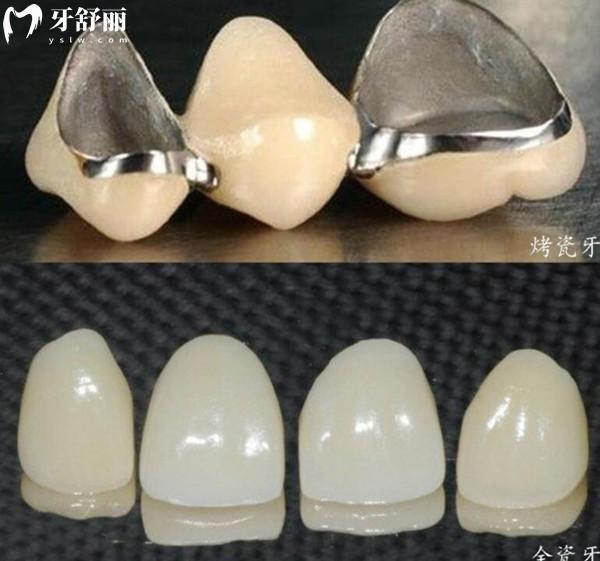 2025雅貝康口腔醫(yī)院價(jià)格表(收費(fèi)不貴)種植牙
