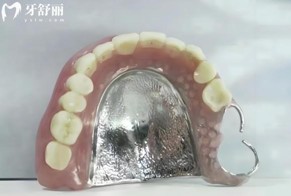 長沙裝吸附性義齒全口假牙需要多少錢
