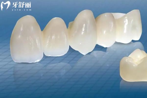 樂口全瓷牙是進(jìn)口的嗎？