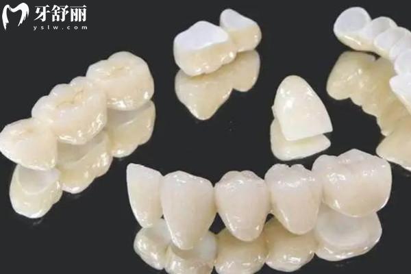 樂口全瓷牙是進(jìn)口的嗎？