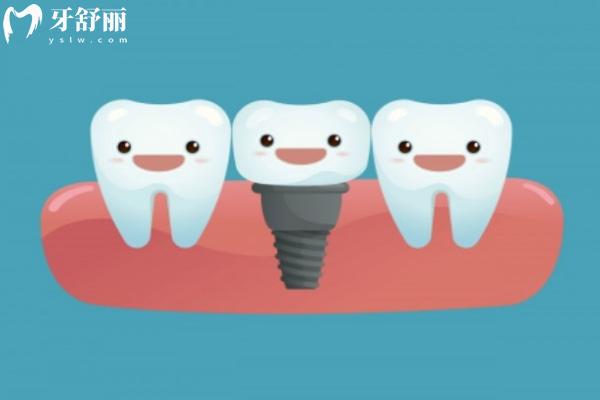 廣州看牙多少錢