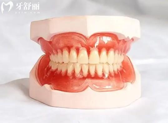 廈門同安區(qū)鑲牙修復(fù)收費情況