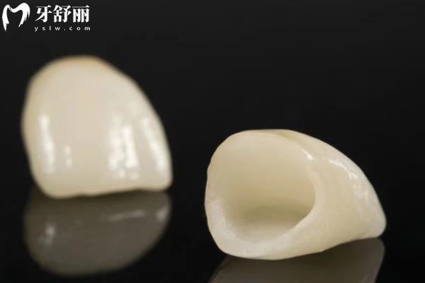 德國牙冠哪家強(qiáng)