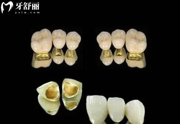 2025無錫維樂口腔(7院)收費(fèi)價(jià)目表在線查詢:種植牙