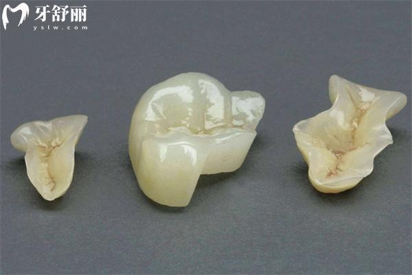 門牙磕掉一小塊怎么補(bǔ)?門牙缺損不同程度的修復(fù)方法有哪些快來了解!