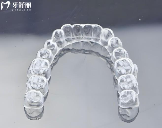 成都牙齒矯正價格表2025公開:暑期學(xué)生矯正優(yōu)惠力度大,收費透明口碑佳