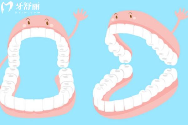 深圳吸附性義齒多少錢
