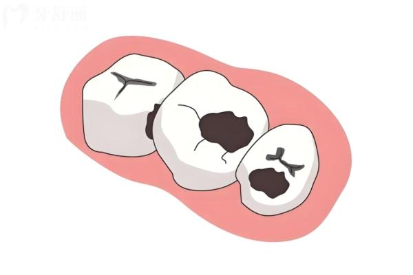 別再被騙！莆田系口腔醫(yī)院能去嗎?揭秘國內(nèi)正規(guī)口腔醫(yī)院哪家好一點(diǎn)放心去