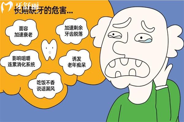 別再煩惱!到底種牙好還是鑲牙好?了解種牙鑲牙的種類和區(qū)別直接選擇
