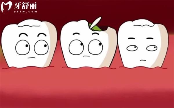 陶瓷嵌體補(bǔ)牙好不好?和樹(shù)脂嵌體補(bǔ)牙哪個(gè)好?3分鐘帶你來(lái)揭秘