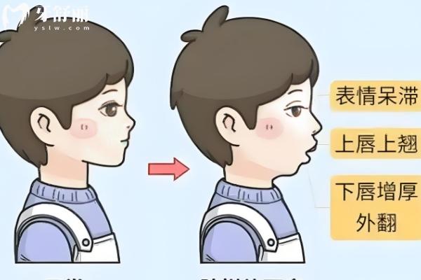 孩子牙齒矯正選正雅還是時代天使