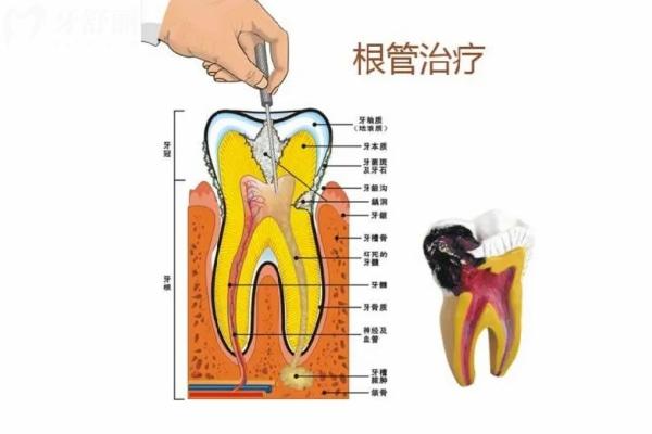 2025寧波口腔醫(yī)院價目表:當(dāng)?shù)厝嗽u價實惠正規(guī)的牙科及價格表快收好