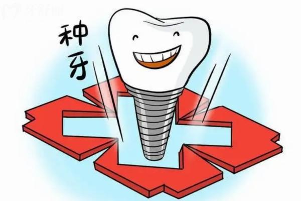 石家莊種植牙2025收費價目表:種牙價格醫(yī)院名單全透明看這篇就夠了！
